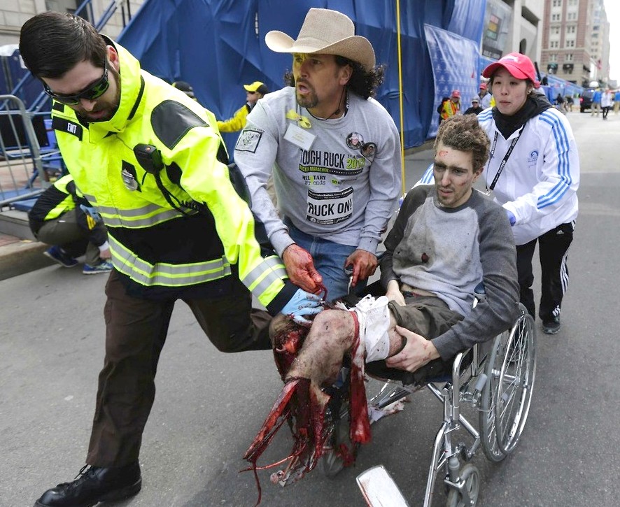 boston-marathon-lost-leg
