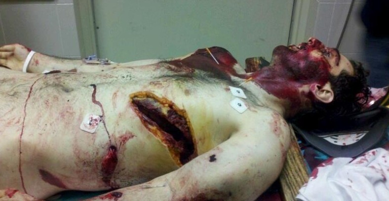 BomberDeathPhotoTamerlan Tsarnaev