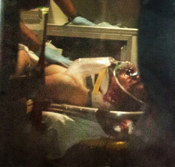 jahar on stretcher