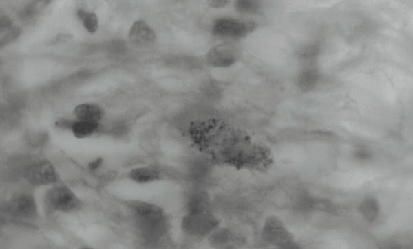 tissue section