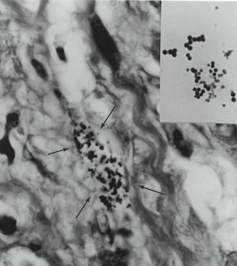 tissue section 2