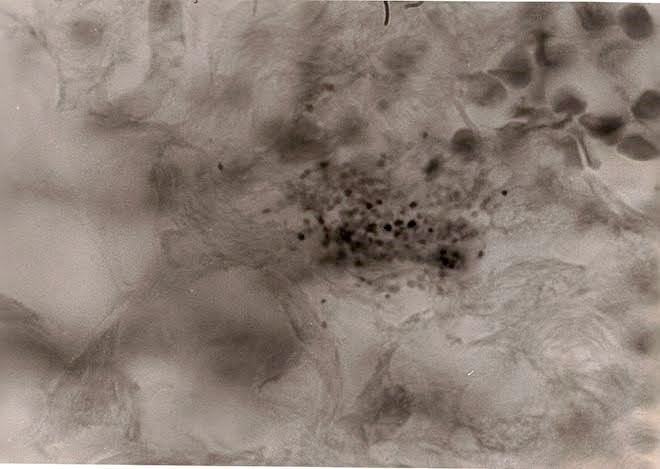 tissue section 3
