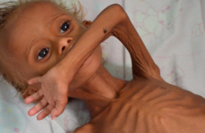 How Can We Live? Part 1, Starvation in Yemen
