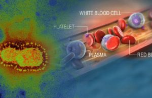 COVID-19 — Stop Treating Patients For the Wrong Disease