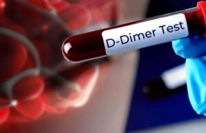 Dr Charles Hoffe Talks About Microscopic Blood Clots in the Brain, Heart and Lungs