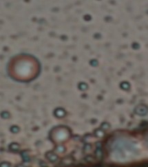 Enby's particles in Pfizer vax,