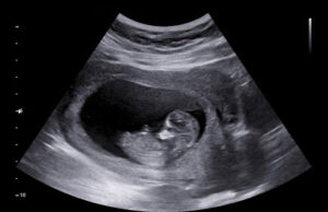 Genocide Agenda — “Anti-humans” at Pfizer, WEF, FDA Etc., Are Targeting The Miraculous Female Body