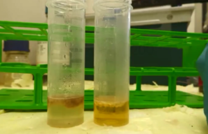Dr Jane Ruby And Mike Adams Discuss Lab Test Results of Vax Blood Clots
