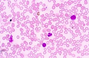 It’s All About The Blood — Evidence In Plain Sight