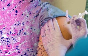 Covid Vaccines Injure the Heart and Cause Myocarditis