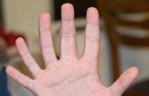 The Six Finger Man
